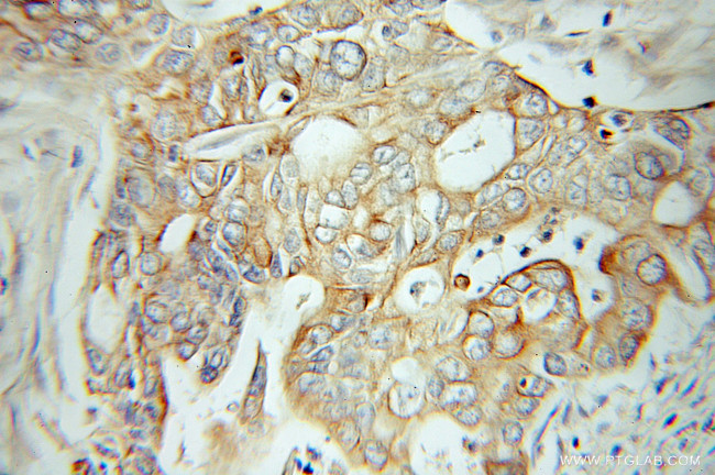 IA-2/PTPRN Antibody in Immunohistochemistry (Paraffin) (IHC (P))