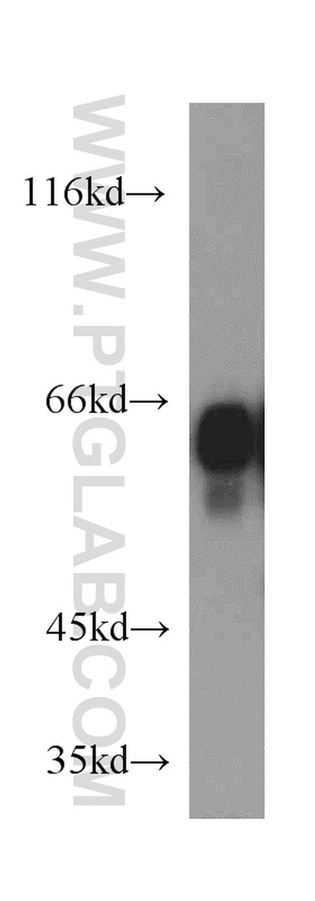 IA-2/PTPRN Antibody in Western Blot (WB)