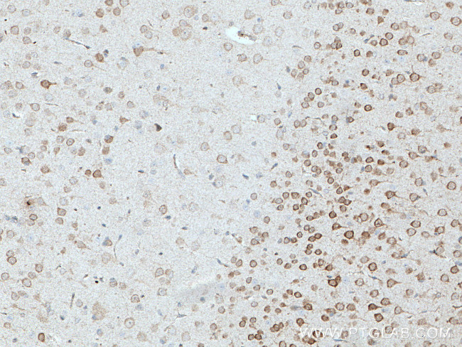 STMN2 Antibody in Immunohistochemistry (Paraffin) (IHC (P))