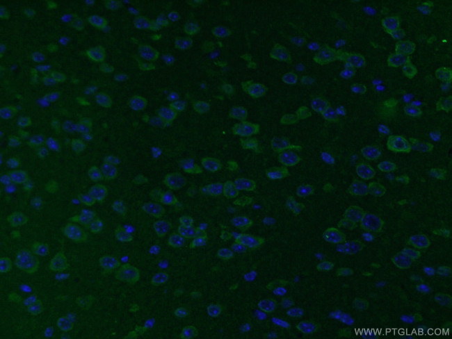 STMN2 Antibody in Immunohistochemistry (PFA fixed) (IHC (PFA))