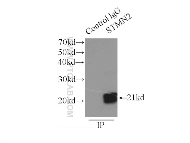 STMN2 Antibody in Immunoprecipitation (IP)
