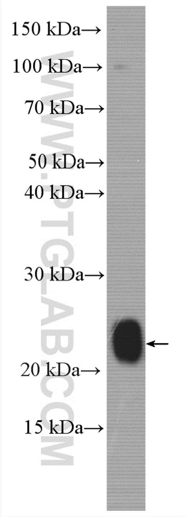 STMN2 Antibody in Western Blot (WB)