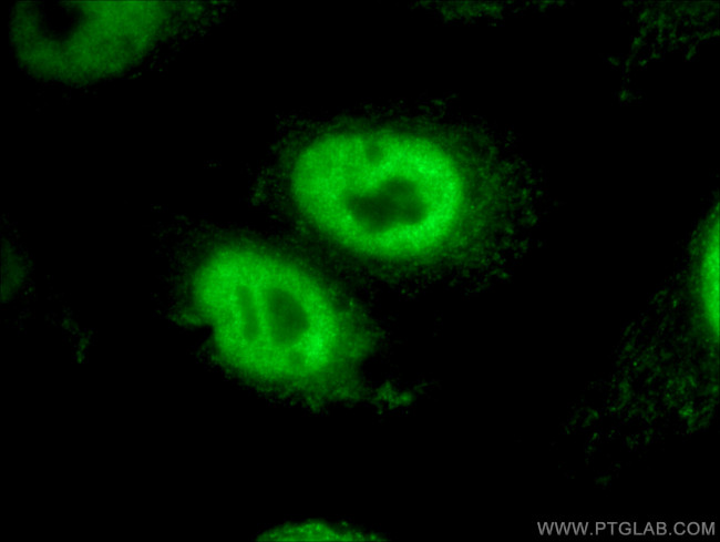 RBM15 Antibody in Immunocytochemistry (ICC/IF)