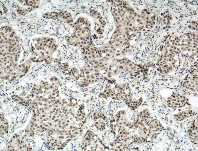 RBM15 Antibody in Immunohistochemistry (Paraffin) (IHC (P))