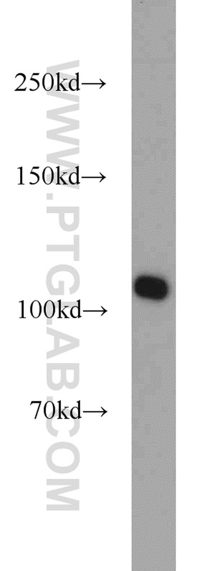 RBM15 Antibody in Western Blot (WB)