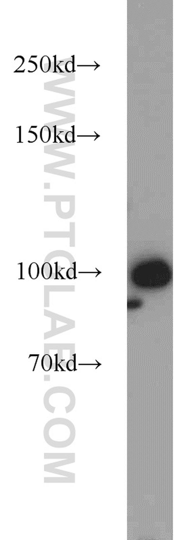 RBM15 Antibody in Western Blot (WB)