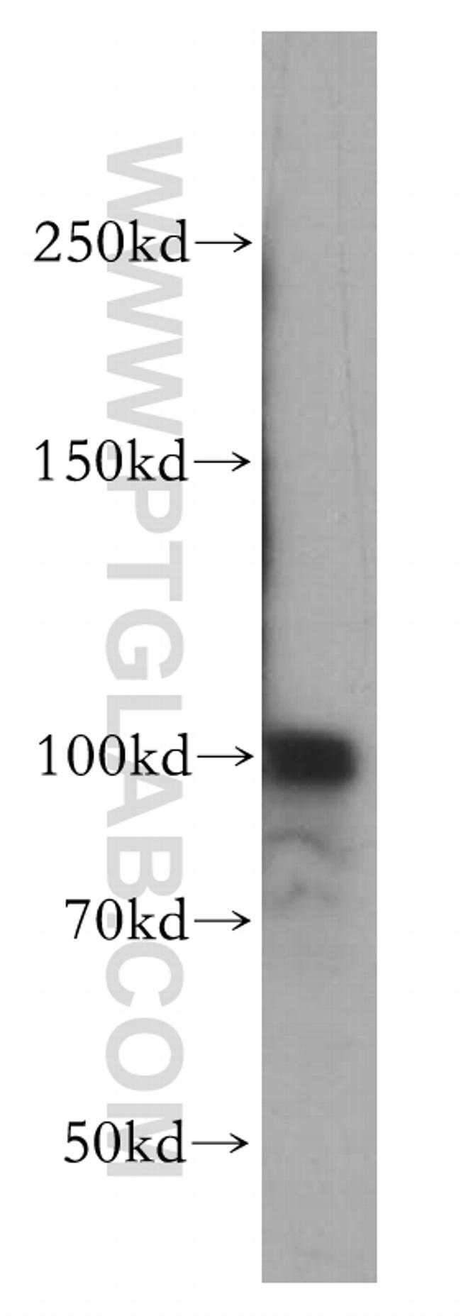 RBM15 Antibody in Western Blot (WB)