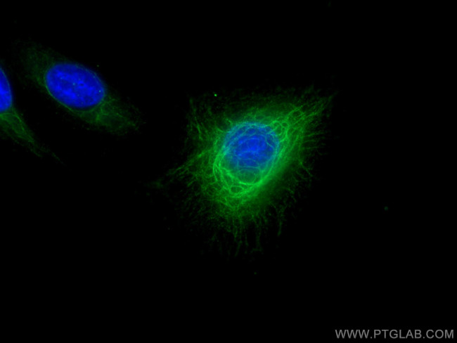 Cytokeratin 6A Antibody in Immunocytochemistry (ICC/IF)