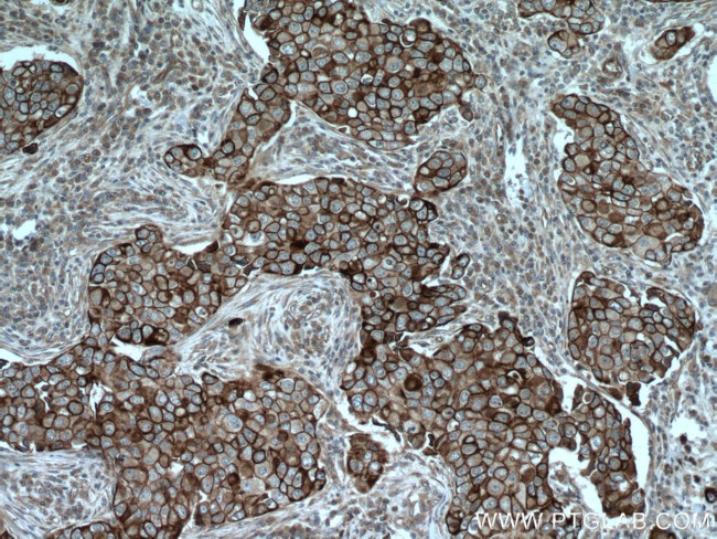 Cytokeratin 6A Antibody in Immunohistochemistry (Paraffin) (IHC (P))