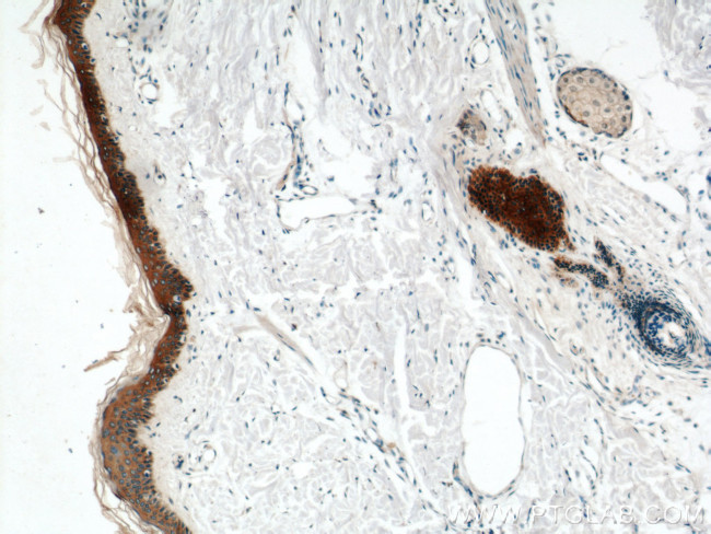 Cytokeratin 6A Antibody in Immunohistochemistry (Paraffin) (IHC (P))