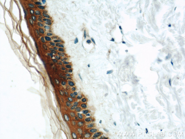 Cytokeratin 6A Antibody in Immunohistochemistry (Paraffin) (IHC (P))