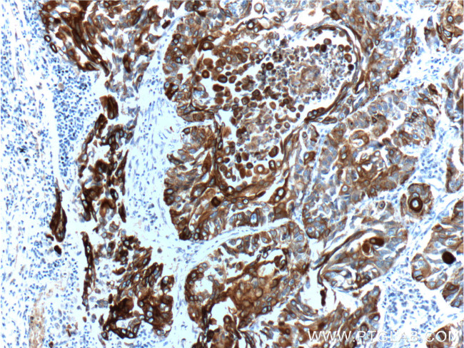 Cytokeratin 6A Antibody in Immunohistochemistry (Paraffin) (IHC (P))