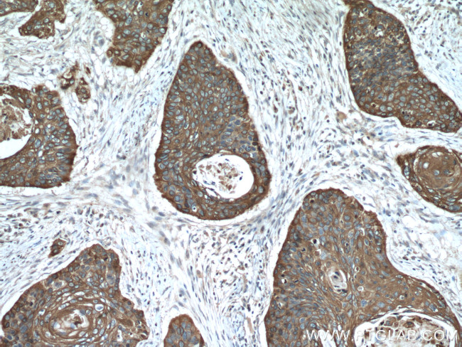 Cytokeratin 6A Antibody in Immunohistochemistry (Paraffin) (IHC (P))