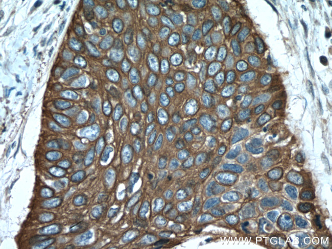 Cytokeratin 6A Antibody in Immunohistochemistry (Paraffin) (IHC (P))