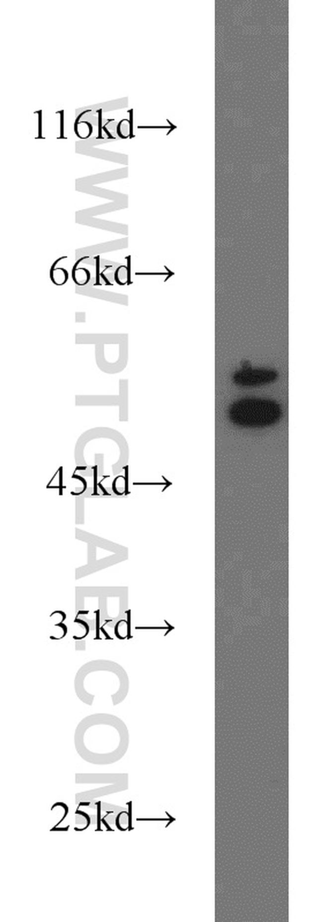 Cytokeratin 6A Antibody in Western Blot (WB)