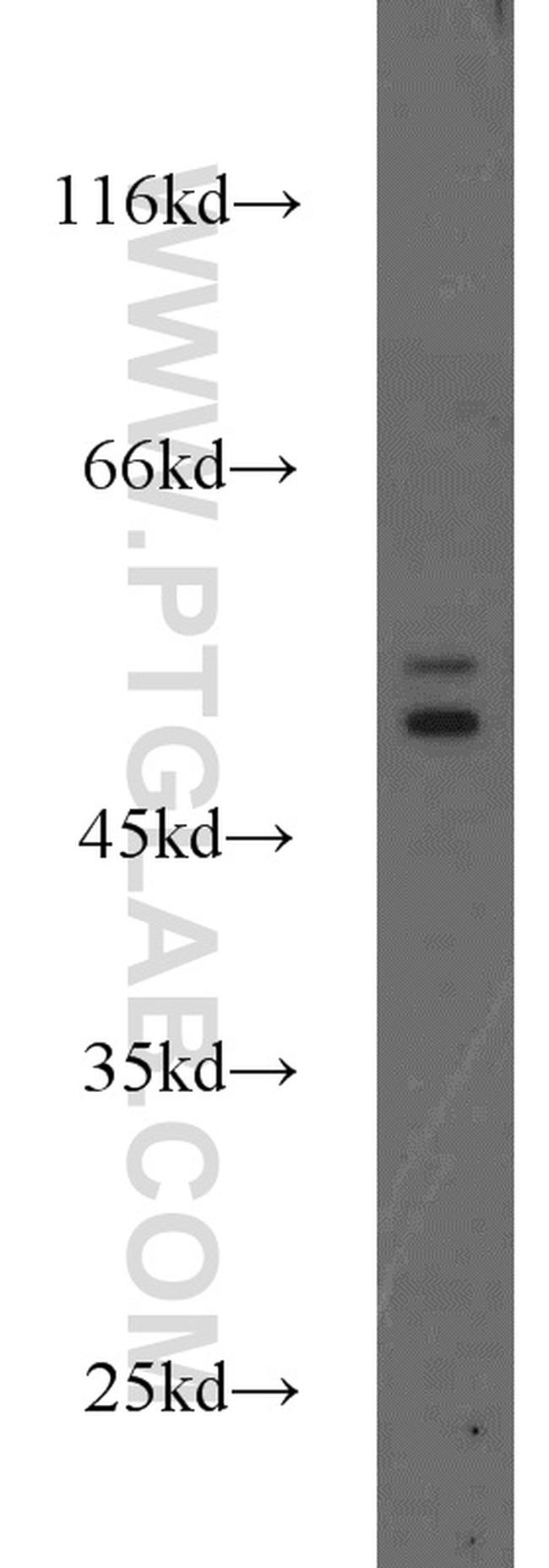 Cytokeratin 6A Antibody in Western Blot (WB)