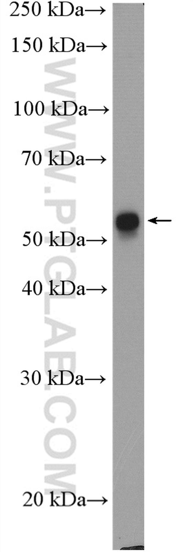 Cytokeratin 6A Antibody in Western Blot (WB)