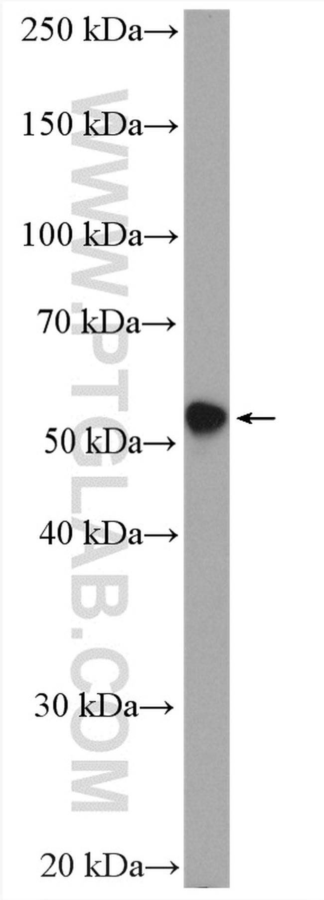 Cytokeratin 6A Antibody in Western Blot (WB)