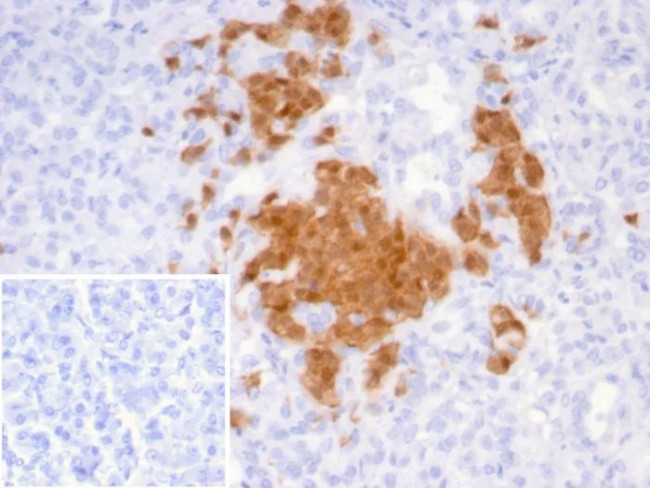 SCGN/Secretagogin Antibody in Immunohistochemistry (Paraffin) (IHC (P))