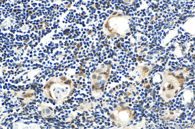 DLX5 Antibody in Immunohistochemistry (Paraffin) (IHC (P))