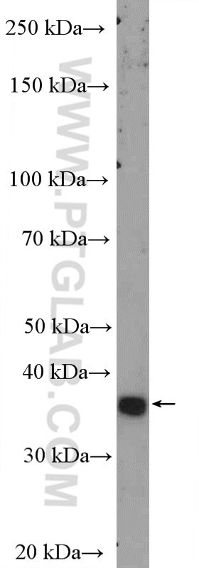 DLX5 Antibody in Western Blot (WB)