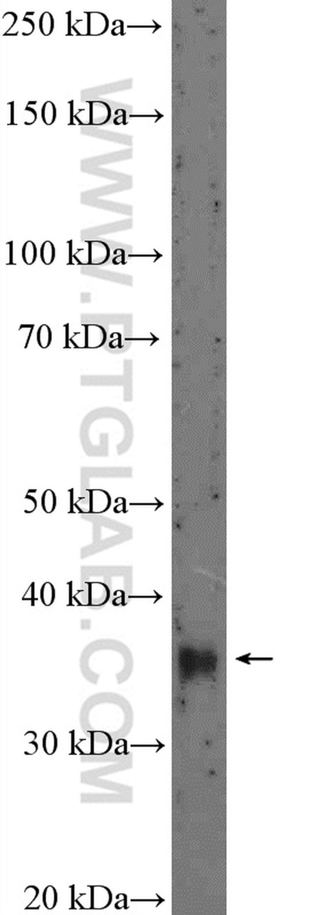 DLX5 Antibody in Western Blot (WB)