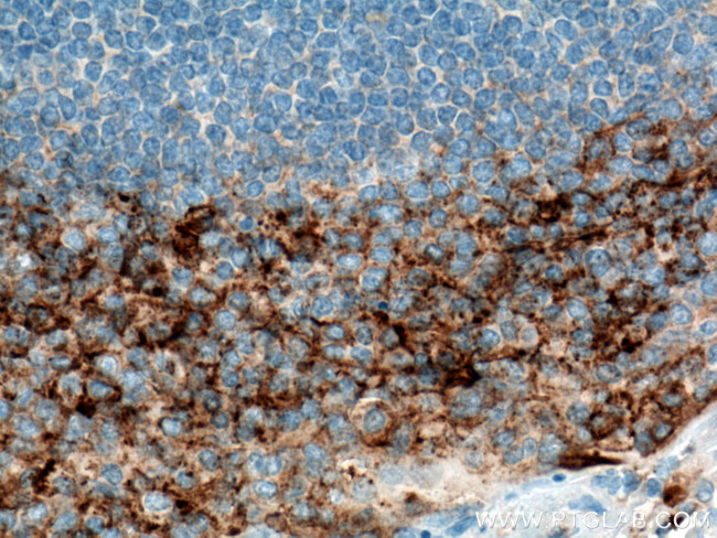 CD138/Syndecan-1 Antibody in Immunohistochemistry (Paraffin) (IHC (P))