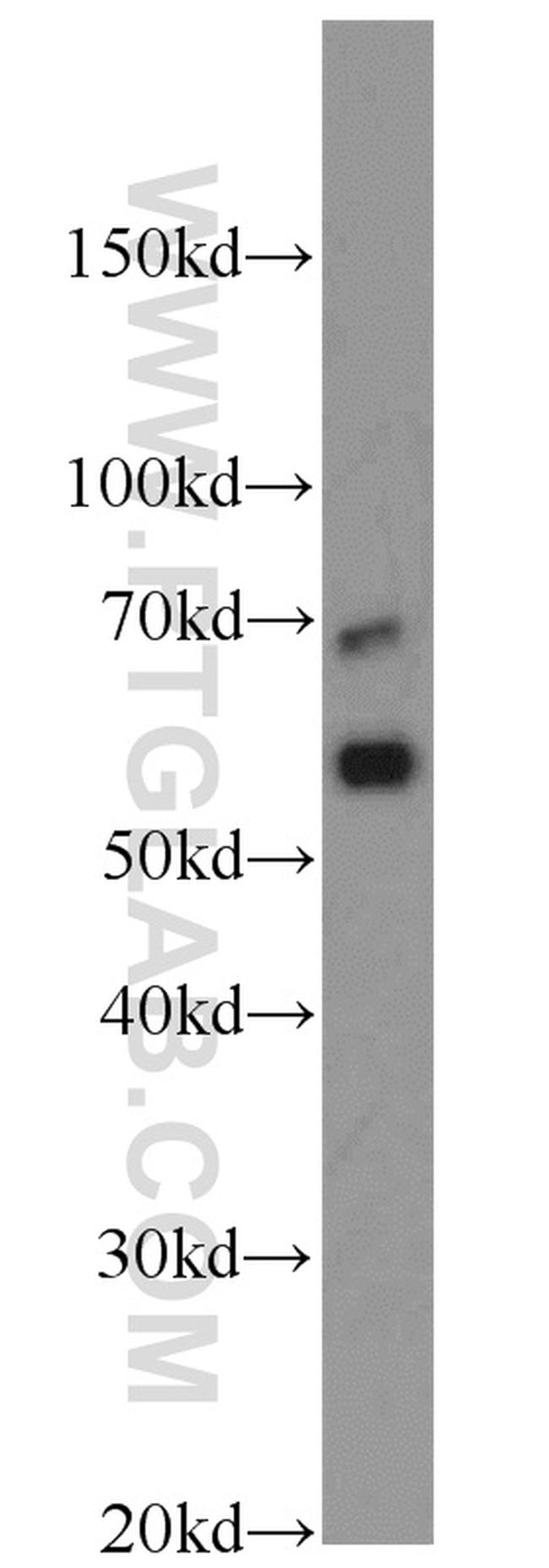 CD138/Syndecan-1 Antibody in Western Blot (WB)