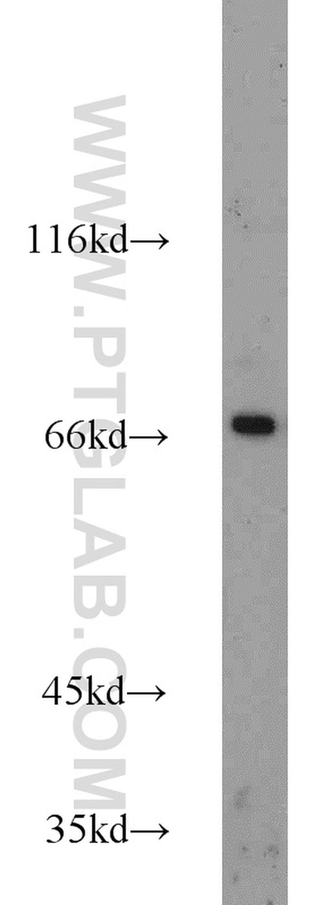 CD138/Syndecan-1 Antibody in Western Blot (WB)