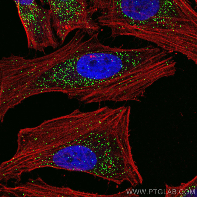 PEX14 Antibody in Immunocytochemistry (ICC/IF)