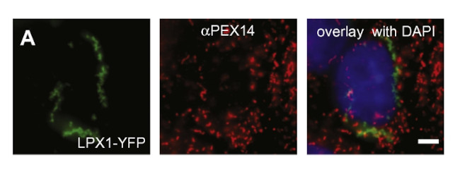 PEX14 Antibody in Immunocytochemistry (ICC/IF)