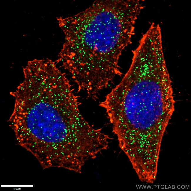 PEX14 Antibody in Immunocytochemistry (ICC/IF)