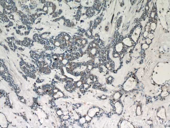 PEX14 Antibody in Immunohistochemistry (Paraffin) (IHC (P))