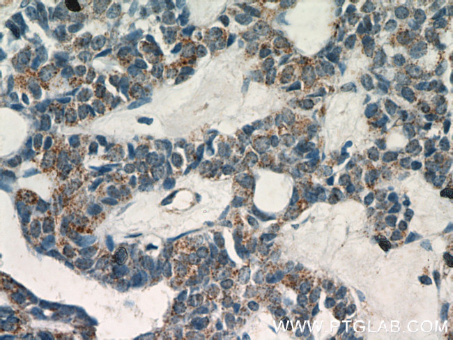 PEX14 Antibody in Immunohistochemistry (Paraffin) (IHC (P))