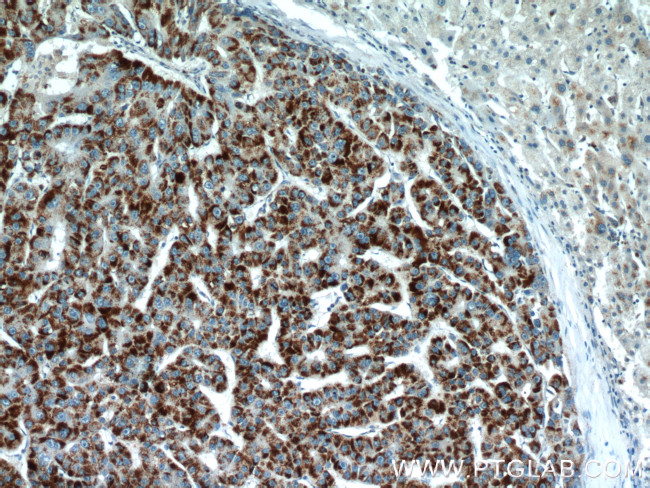 PEX14 Antibody in Immunohistochemistry (Paraffin) (IHC (P))