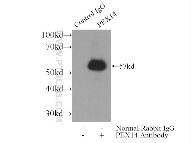 PEX14 Antibody in Immunoprecipitation (IP)