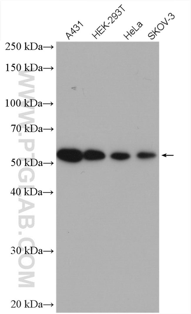 PEX14 Antibody in Western Blot (WB)