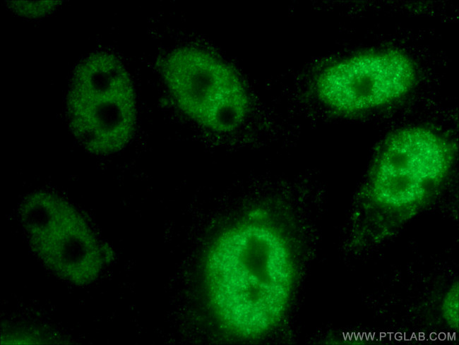 HEY2 Antibody in Immunocytochemistry (ICC/IF)