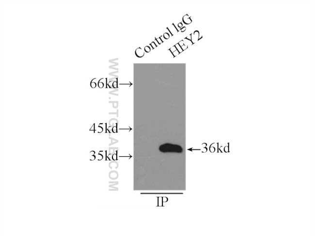 HEY2 Antibody in Immunoprecipitation (IP)