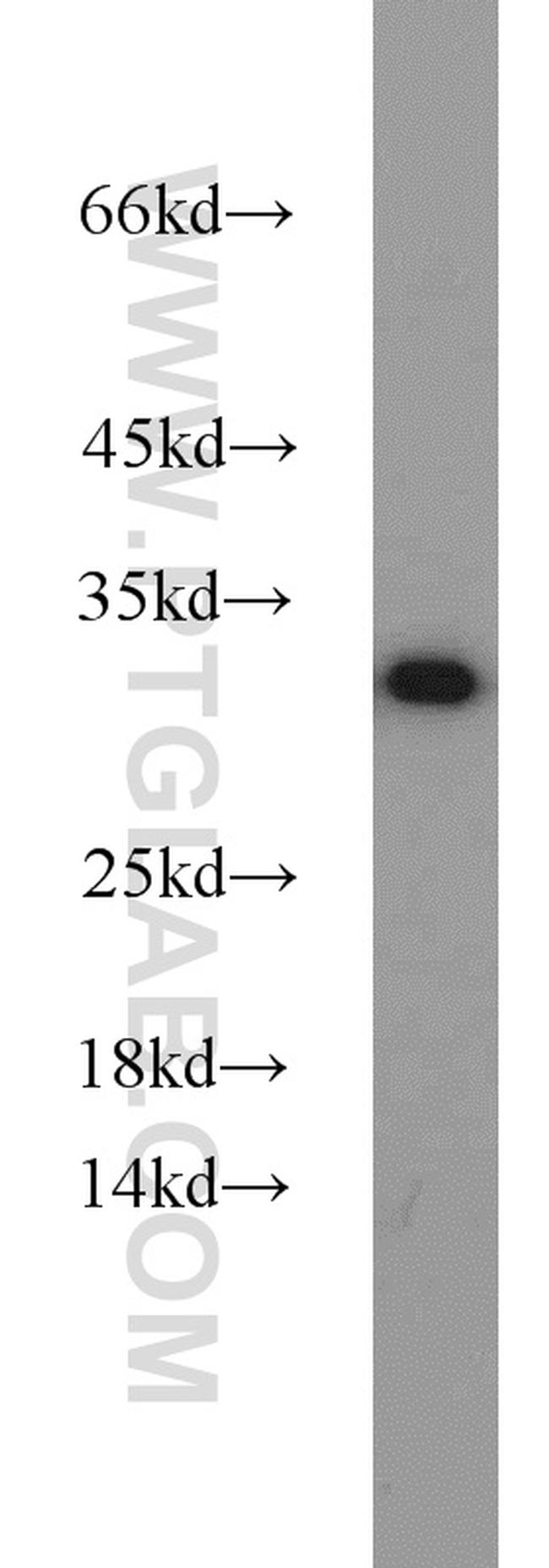 HEY2 Antibody in Western Blot (WB)