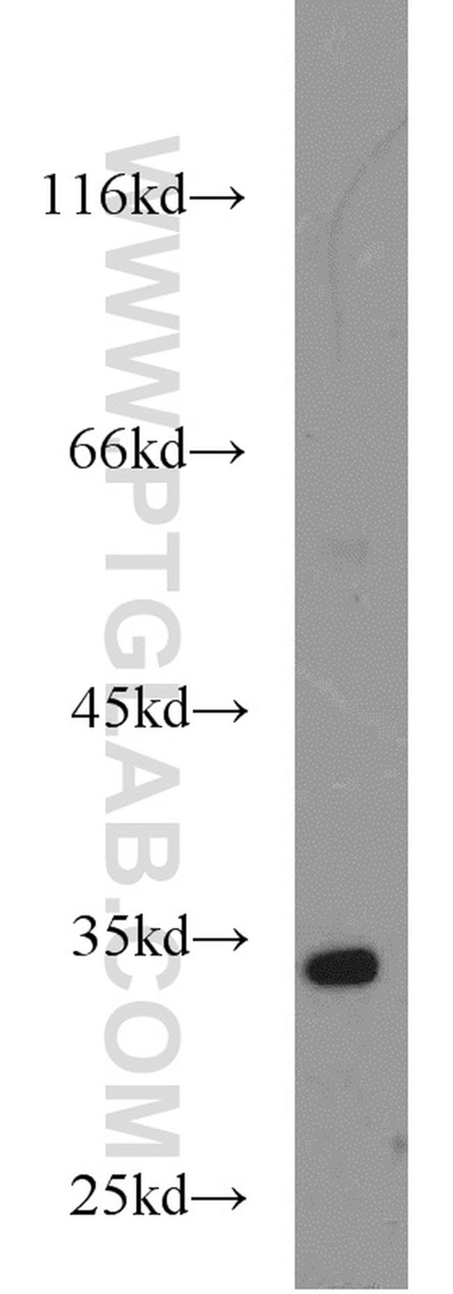 HEY2 Antibody in Western Blot (WB)