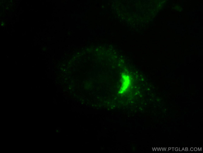 GORASP2 Antibody in Immunocytochemistry (ICC/IF)