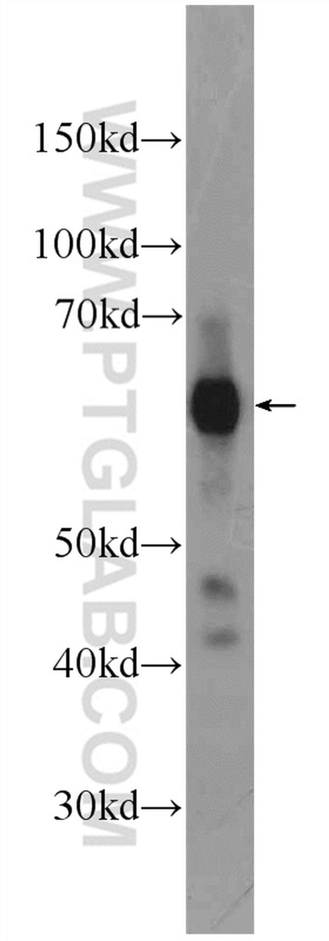 GORASP2 Antibody in Western Blot (WB)