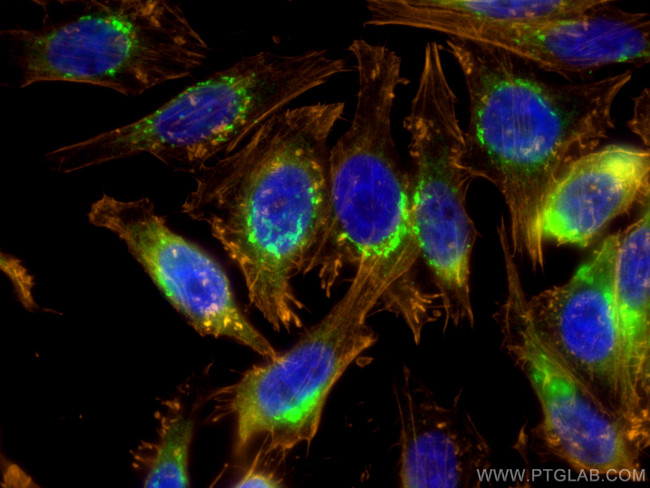 GORASP2 Antibody in Immunocytochemistry (ICC/IF)