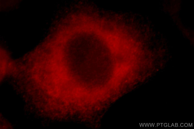 BAG3 Antibody in Immunocytochemistry (ICC/IF)