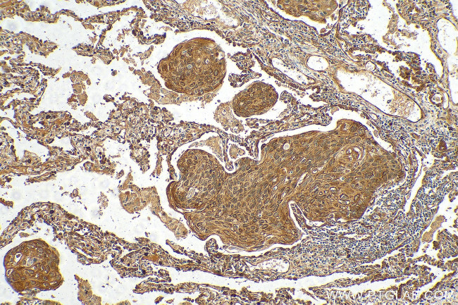 BAG3 Antibody in Immunohistochemistry (Paraffin) (IHC (P))