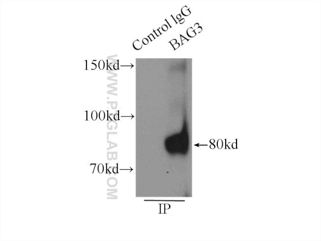 BAG3 Antibody in Immunoprecipitation (IP)