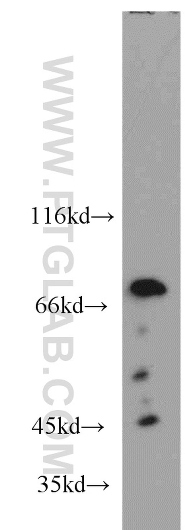 BAG3 Antibody in Western Blot (WB)