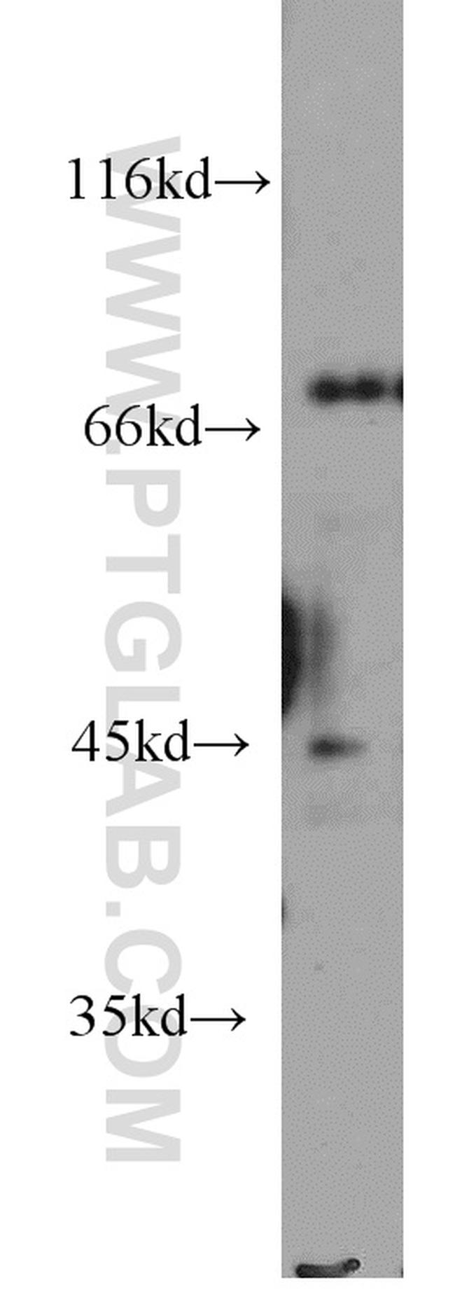 BAG3 Antibody in Western Blot (WB)