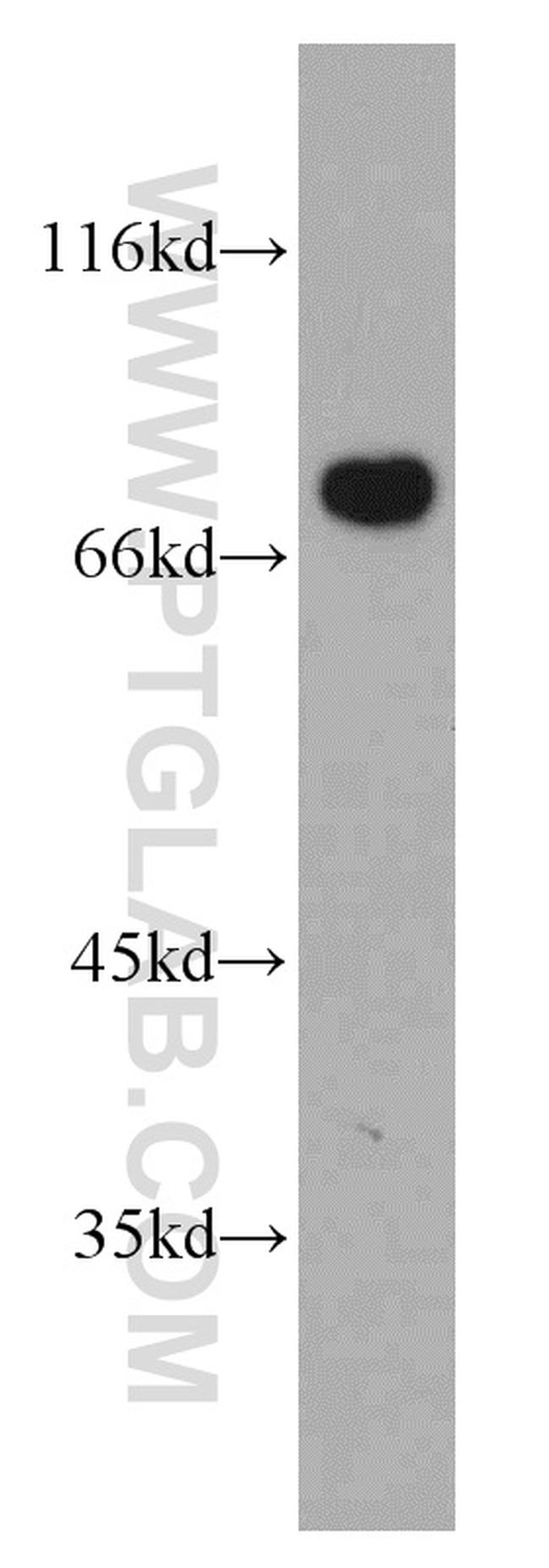 BAG3 Antibody in Western Blot (WB)